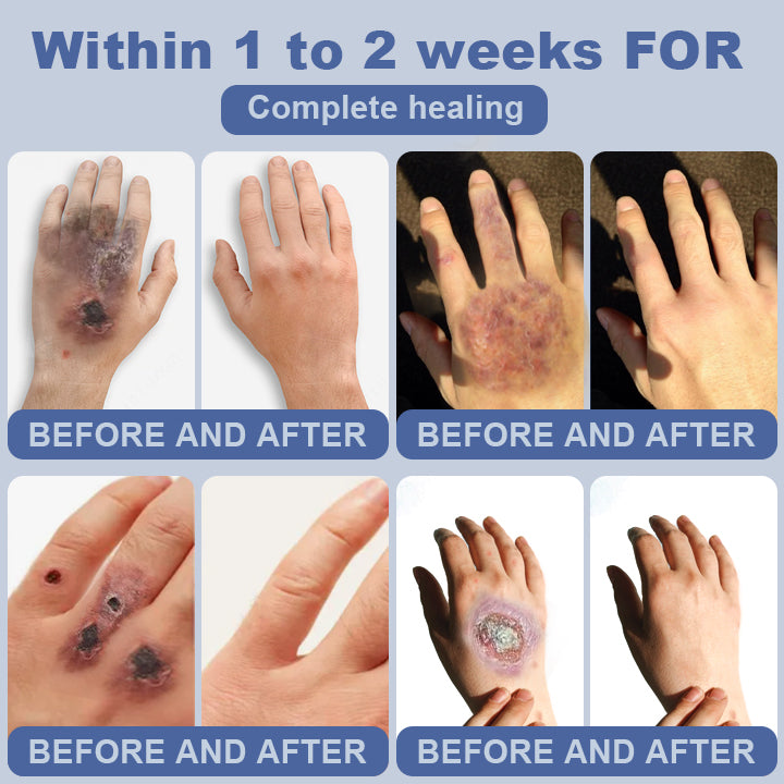 SugarSkin Repair Cream