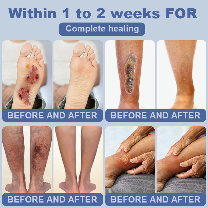 SugarSkin Repair Cream