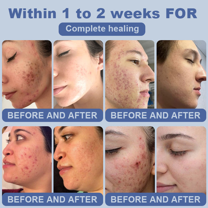 SugarSkin Repair Cream