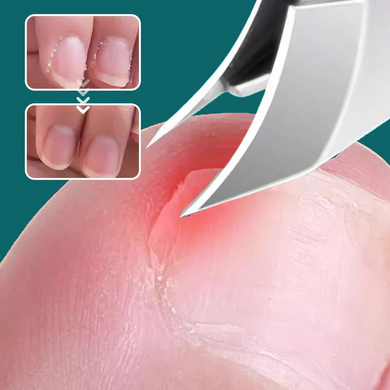 Anti-Splash 25° Slant Edge Nail Clipper 3-Piece Set